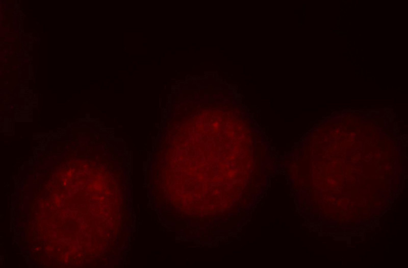 Immunofluorescent analysis of HepG2 cells, using MYBL2 antibody Catalog No:117206 at 1:25 dilution and Rhodamine-labeled goat anti-rabbit IgG (red).