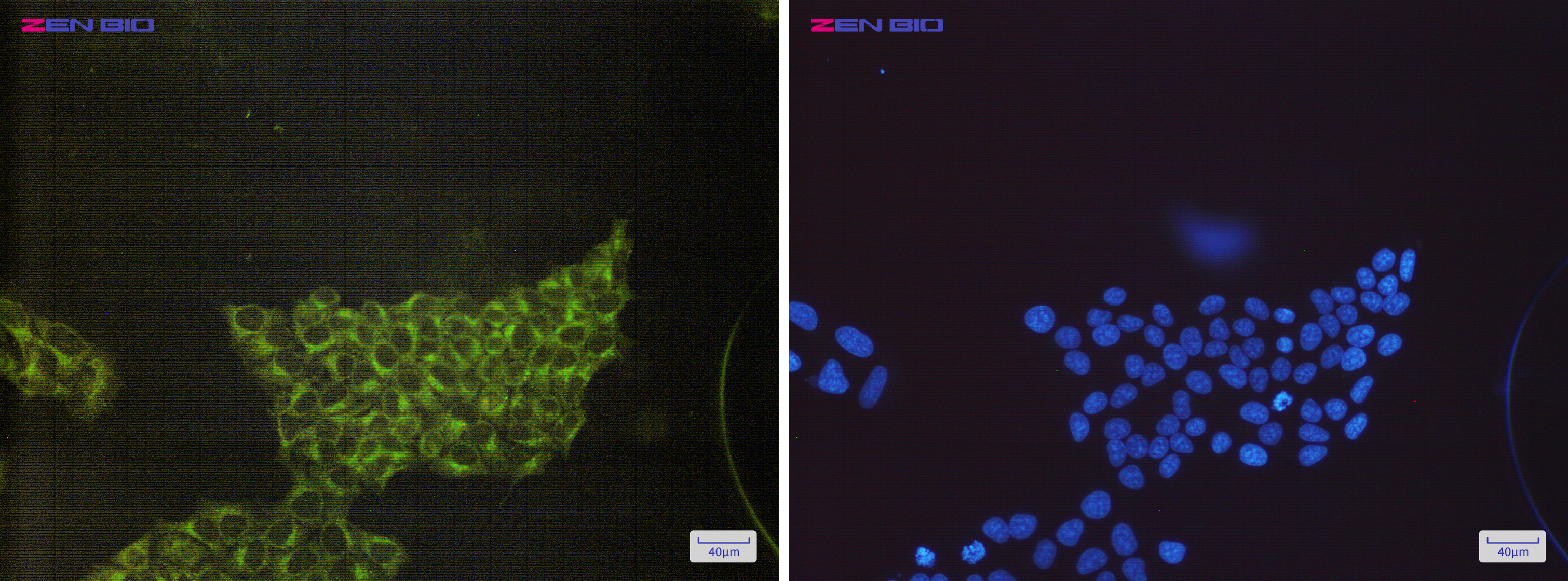 Immunocytochemistry of S6K1(green) in Hela cells using S6K1 Rabbit mAb at dilution 1/200, and DAPI(blue)