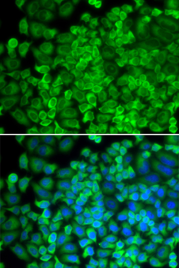 Immunofluorescence - GLA Polyclonal Antibody 