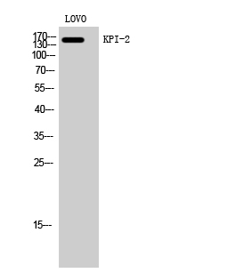 Fig1:; Western Blot analysis of LOVO cells using KPI-2 Polyclonal Antibody