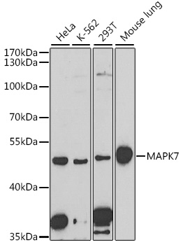 Western blot - MAPK7 Polyclonal Antibody 