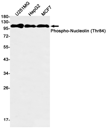Western blot detection of Phospho-Nucleolin (Thr84) in U251MG,HepG2,Hela cell lysates using Phospho-Nucleolin (Thr84) Rabbit mAb(1:500 diluted).Predicted band size:77kDa.Observed band size:100kDa.