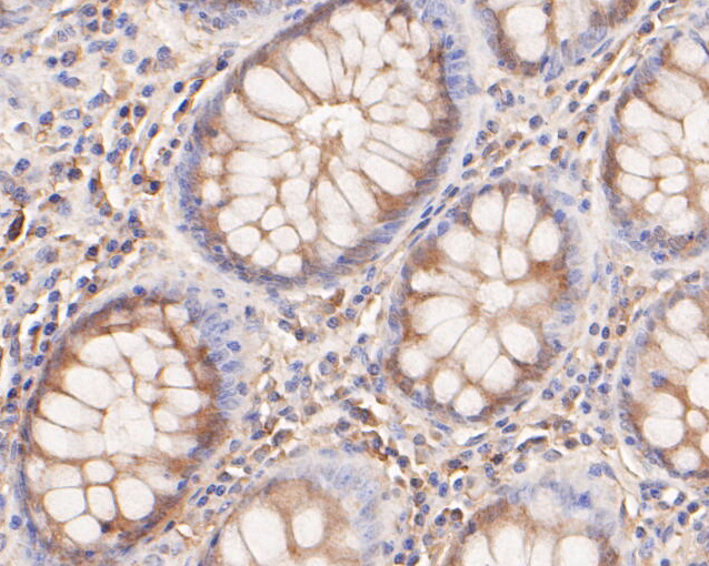 Fig6:; Immunohistochemical analysis of paraffin-embedded human colon tissue using anti-KCNN2 antibody. The section was pre-treated using heat mediated antigen retrieval with Tris-EDTA buffer (pH 8.0-8.4) for 20 minutes.The tissues were blocked in 5% BSA for 30 minutes at room temperature, washed with ddH; 2; O and PBS, and then probed with the primary antibody ( 1/100) for 30 minutes at room temperature. The detection was performed using an HRP conjugated compact polymer system. DAB was used as the chromogen. Tissues were counterstained with hematoxylin and mounted with DPX.