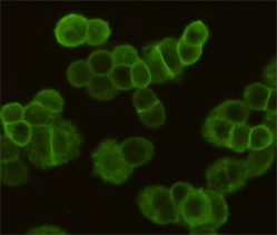 Immunocytochemistry staining of MDA-MB-468 cells fixed with 4% Paraformaldehyde and using EGFR mouse mAb (dilution 1:200).