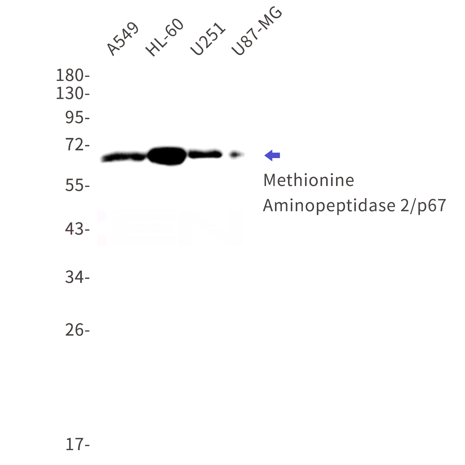Western blot detection of Methionine Aminopeptidase 2/p67 in A549,HL-60,U251,U87-MG cell lysates using Methionine Aminopeptidase 2/p67 Rabbit mAb(1:1000 diluted).Predicted band size:53kDa.Observed band size:67kDa.