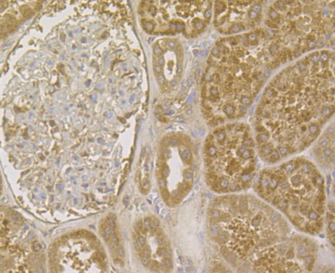 Fig4: Immunohistochemical analysis of paraffin-embedded human kidney tissue using anti-RYR3 antibody. The section was pre-treated using heat mediated antigen retrieval with Tris-EDTA buffer (pH 8.0-8.4) for 20 minutes.The tissues were blocked in 5% BSA for 30 minutes at room temperature, washed with ddH2O and PBS, and then probed with the antibody at 1/200 dilution, for 30 minutes at room temperature and detected using an HRP conjugated compact polymer system. DAB was used as the chrogen. Counter stained with hematoxylin and mounted with DPX.