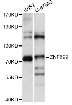 Western blot - ZNF699 Polyclonal Antibody 