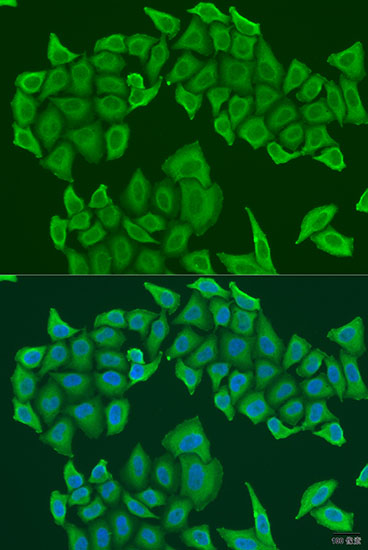 Immunofluorescence - HAUS8 Polyclonal Antibody 