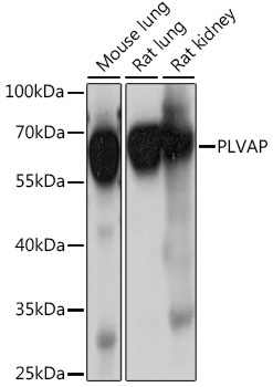 Western blot - PLVAP Polyclonal Antibody 