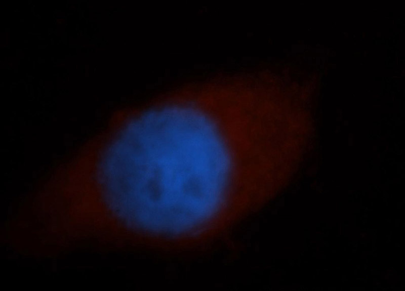 Immunofluorescent analysis of MCF-7 cells, using PAIP1 antibody Catalog No:113494 at 1:50 dilution and Rhodamine-labeled goat anti-rabbit IgG (red). Blue pseudocolor = DAPI (fluorescent DNA dye).