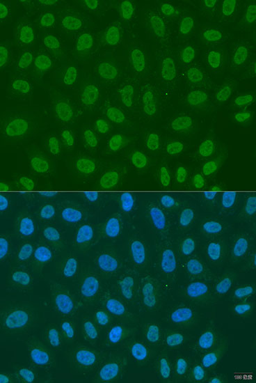 Immunofluorescence - LSM2 Polyclonal Antibody 