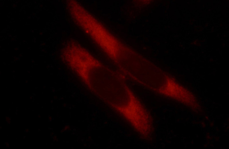 Immunofluorescent analysis of HeLa cells using Catalog No:116096(TMEM127 Antibody) at dilution of 1:25 and Rhodamine-Goat anti-Rabbit IgG