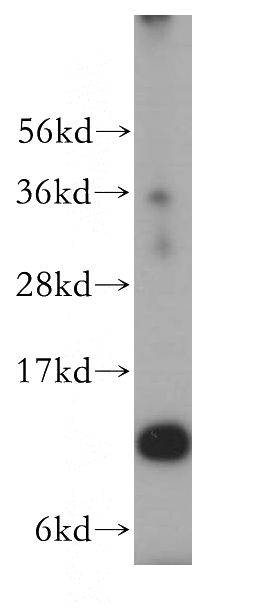 A549 cells were subjected to SDS PAGE followed by western blot with Catalog No:114888(RPL30 antibody) at dilution of 1:500