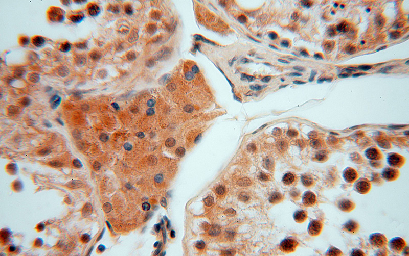 Immunohistochemical of paraffin-embedded human testis using Catalog No:115406(SMYD1-Specific antibody) at dilution of 1:50 (under 40x lens)