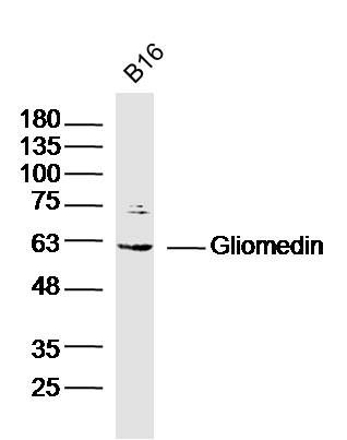 Fig2: Sample:; B16(Mouse) Cell Lysate at 30 ug; Primary: Anti-Gliomedin at 1/300 dilution; Secondary: IRDye800CW Goat Anti-Rabbit IgG at 1/20000 dilution; Predicted band size: 59 kD; Observed band size: 59 kD