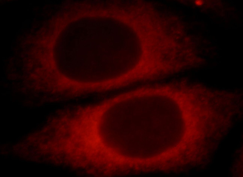 Immunofluorescent analysis of HepG2 cells, using UBXN4 antibody Catalog No:116667 at 1:25 dilution and Rhodamine-labeled goat anti-rabbit IgG (red).