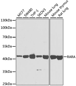 Western blot - RARA Polyclonal Antibody 