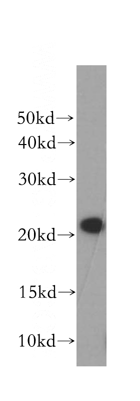 human liver tissue were subjected to SDS PAGE followed by western blot with Catalog No:109443(COMMD1 antibody) at dilution of 1:1000