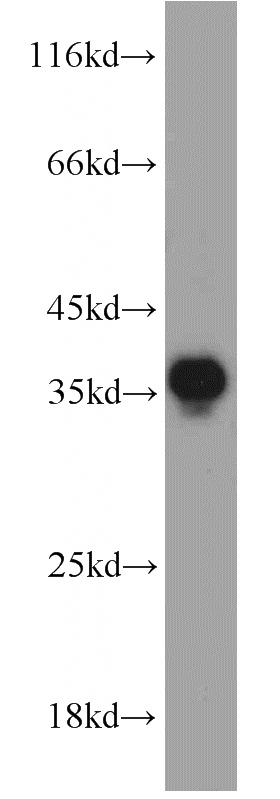 Jurkat cells were subjected to SDS PAGE followed by western blot with Catalog No:114355(PYCR2 antibody) at dilution of 1:800