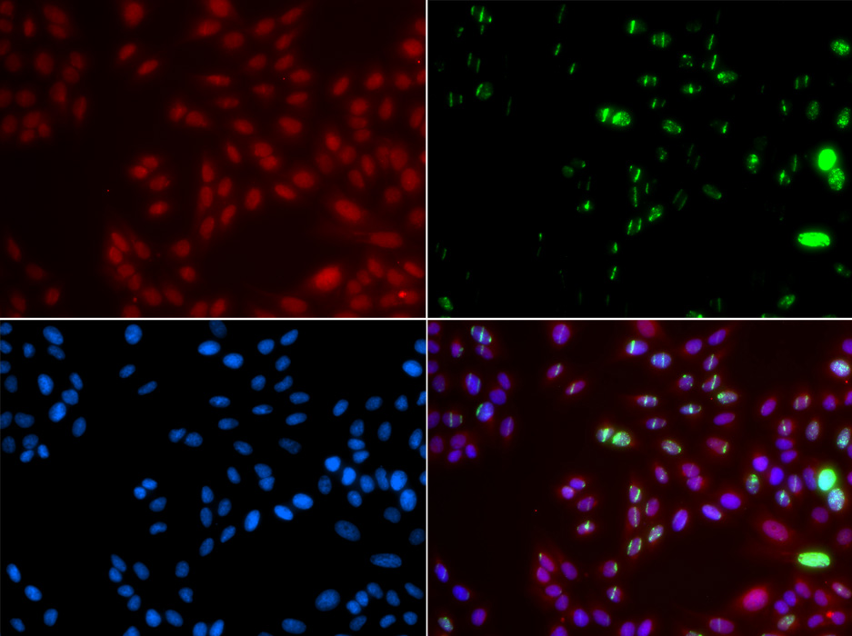 Immunofluorescence - XPA Polyclonal Antibody 