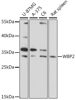 Western blot - WBP2 Polyclonal Antibody 