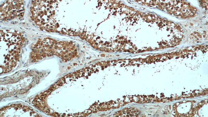 Immunohistochemical of paraffin-embedded human testis using Catalog No:113778(PGAP1 antibody) at dilution of 1:50 (under 10x lens)