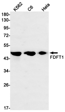 Western blot detection of FDFT1 in K562,C6,Hela cell lysates using FDFT1 Rabbit mAb(1:1000 diluted).Predicted band size:48kDa.Observed band size:48kDa.
