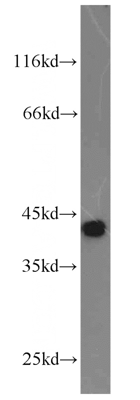 Jurkat cells were subjected to SDS PAGE followed by western blot with Catalog No:113612(SPK antibody) at dilution of 1:600