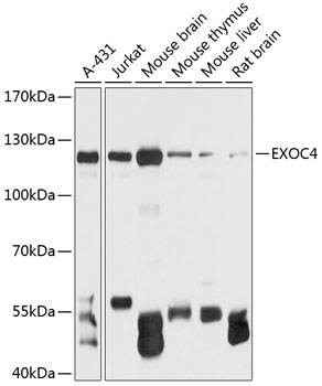 Western blot - EXOC4 Polyclonal Antibody 