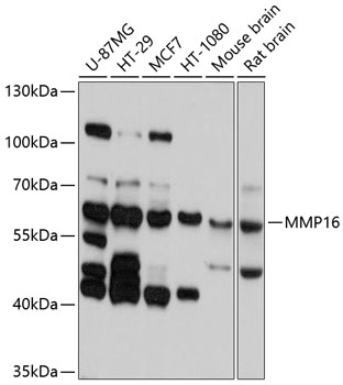 Western blot - MMP16 Polyclonal Antibody 