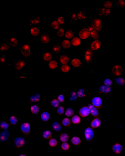 Immunofluorescence - CYP27B1 Polyclonal Antibody 