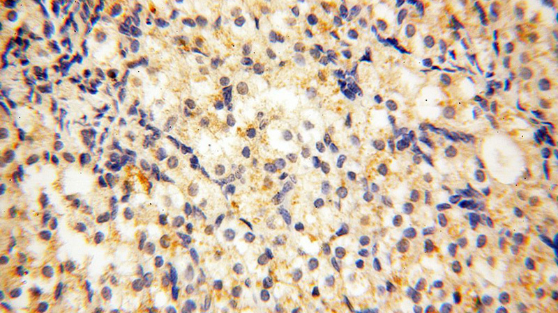 Immunohistochemical of paraffin-embedded human ovary using Catalog No:113143(NFATC3 antibody) at dilution of 1:100 (under 40x lens)