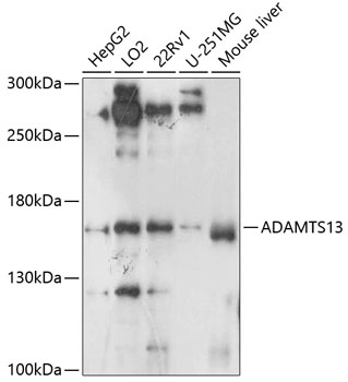 Western blot - ADAMTS13 Polyclonal Antibody 