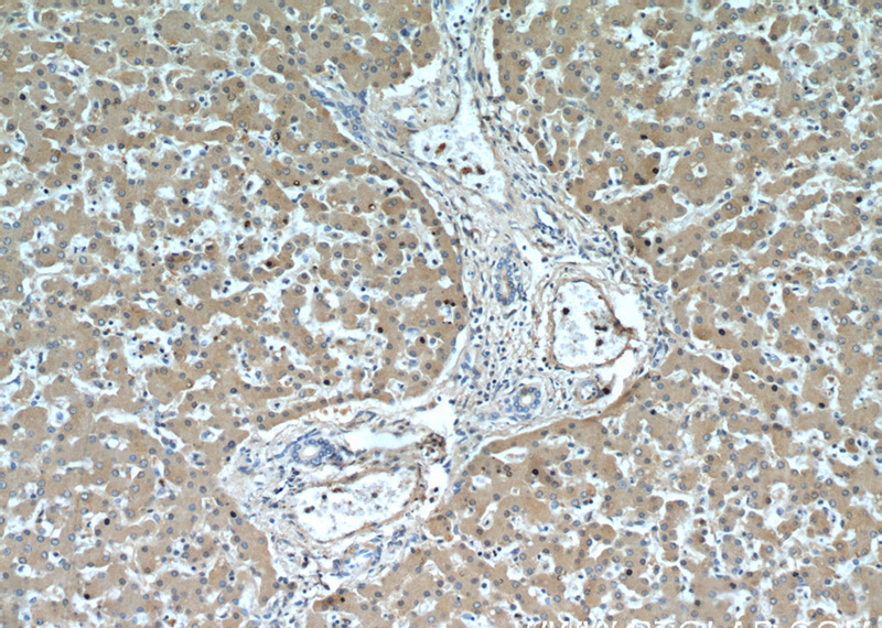 Immunohistochemistry of paraffin-embedded human liver slide using Catalog No:112318(LRG1 Antibody) at dilution of 1:50