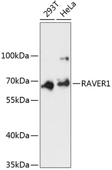Western blot - RAVER1 Polyclonal Antibody 