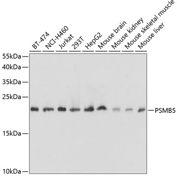 Western blot - PSMB5 Polyclonal Antibody 