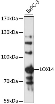 Western blot - LOXL4 Polyclonal Antibody 