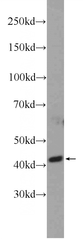 Y79 cells were subjected to SDS PAGE followed by western blot with Catalog No:107919(AIPL1 Antibody) at dilution of 1:600