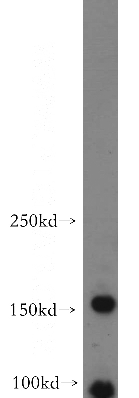 SH-SY5Y cells were subjected to SDS PAGE followed by western blot with Catalog No:108187(FLJ10357 antibody) at dilution of 1:300