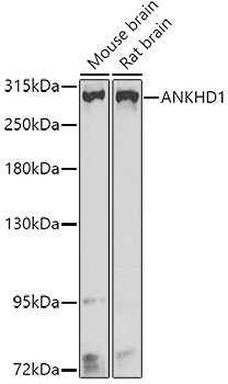 Western blot - ANKHD1 Polyclonal Antibody 