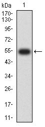 Fig1: Western blot analysis of WDFY3 against human WDFY3 (AA: 3277-3526) recombinant protein. Proteins were transferred to a PVDF membrane and blocked with 5% BSA in PBS for 1 hour at room temperature. The primary antibody ( 1/500) was used in 5% BSA at room temperature for 2 hours. Goat Anti-Mouse IgG - HRP Secondary Antibody at 1:5,000 dilution was used for 1 hour at room temperature.