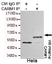 Immunoprecipitation analysis of Hela cell lysates using PRMT4/CARM1 mouse mAb.