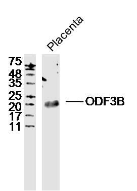 Fig1: Sample: Placenta (Mouse) Lysate at 40 ug; Primary: Anti-ODF3B at 1/300 dilution; Secondary: IRDye800CW Goat Anti-Rabbit IgG at 1/20000 dilution; Predicted band size: 27 kD; Observed band size: 23 kD