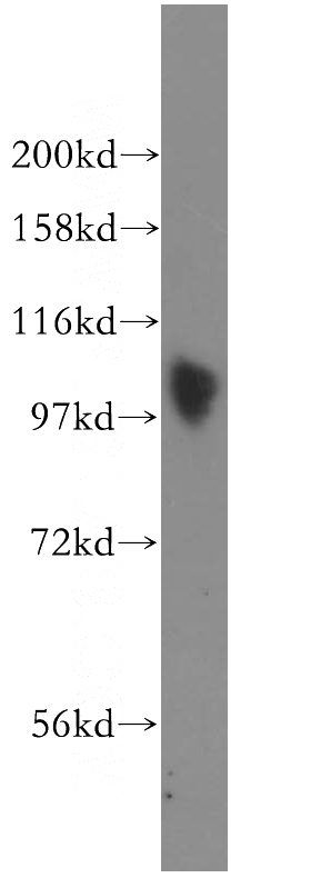 Jurkat cells were subjected to SDS PAGE followed by western blot with Catalog No:115522(SP100 antibody) at dilution of 1:400