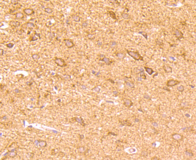 Fig5: Immunohistochemical analysis of paraffin-embedded rat brain tissue using anti-CD137 antibody. Counter stained with hematoxylin.