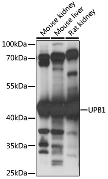 Western blot - UPB1 Polyclonal Antibody 