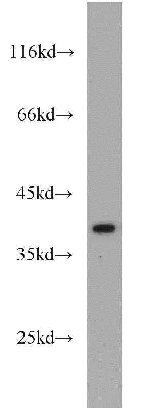 HeLa cells were subjected to SDS PAGE followed by western blot with Catalog No:111639(NFKBIA antibody) at dilution of 1:500