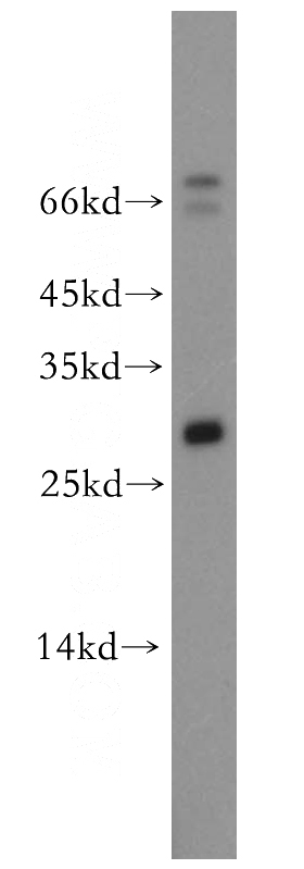A431 cells were subjected to SDS PAGE followed by western blot with Catalog No:113134(NTF4 antibody) at dilution of 1:300