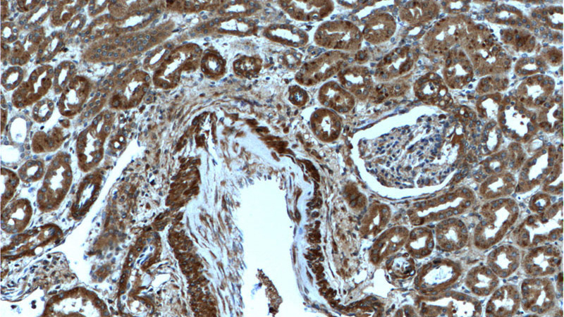 Immunohistochemistry of paraffin-embedded human kidney tissue slide using Catalog No:115199(Corticosteroid binding globulin Antibody) at dilution of 1:200 (under 10x lens).