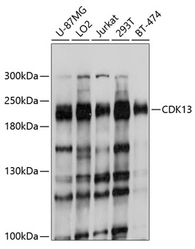 Western blot - CDK13 Polyclonal Antibody 